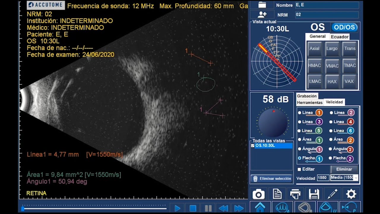 Configuración e instalación del 4Sight