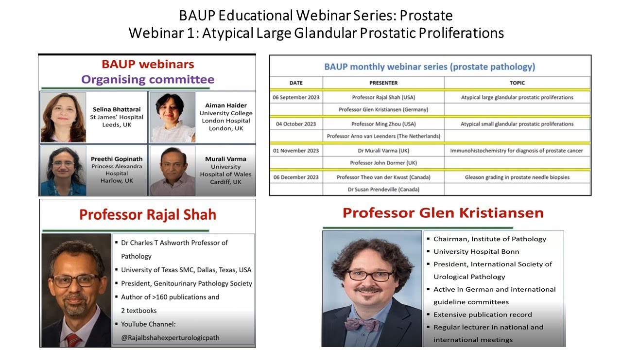 BAUP Webinar on Atypical Large Gland Prostatic Proliferations