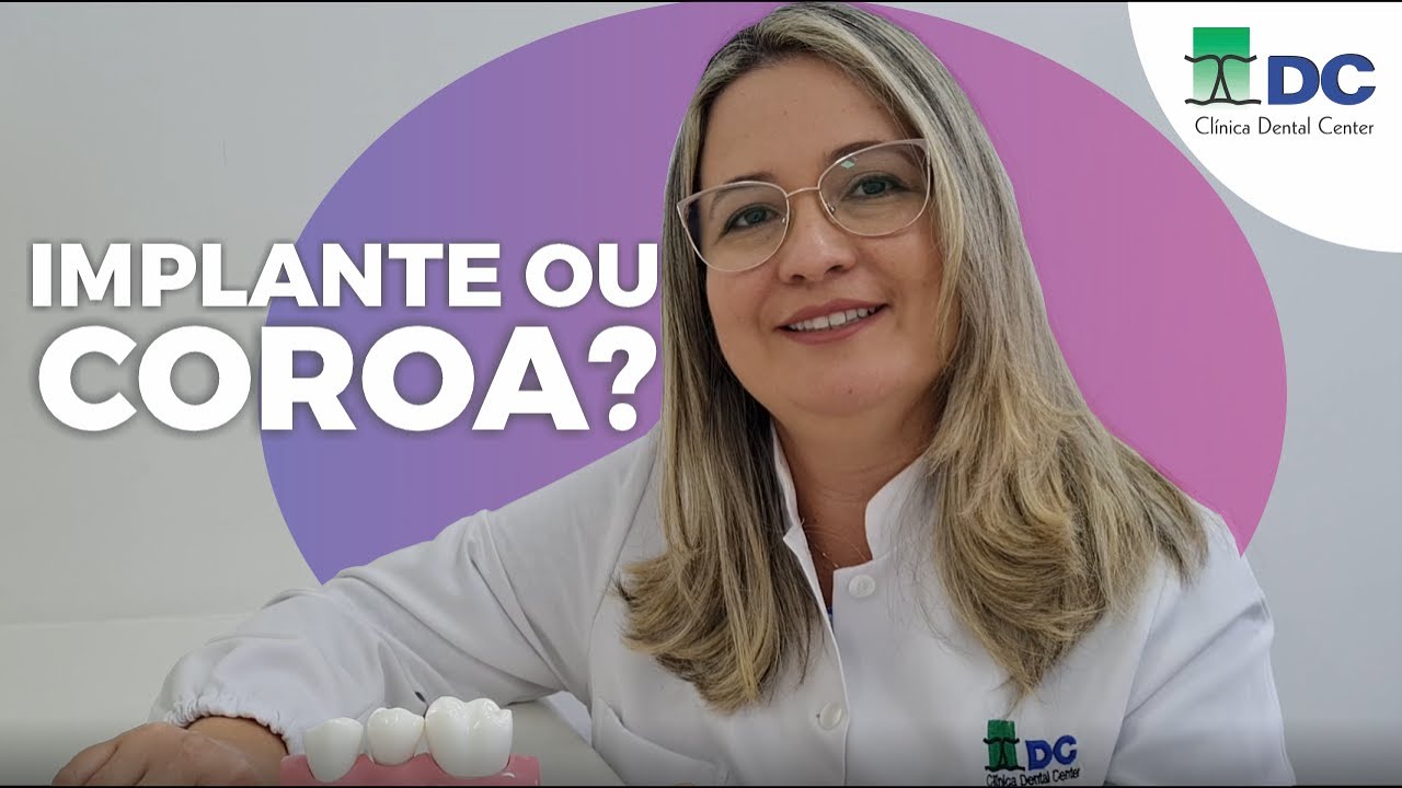 ENTENDA E NÃO ERRE MAIS NA HORA DE IDENTIFICAR: IMPLANTE OU COROA | Dra INGRID BITTENCOURT