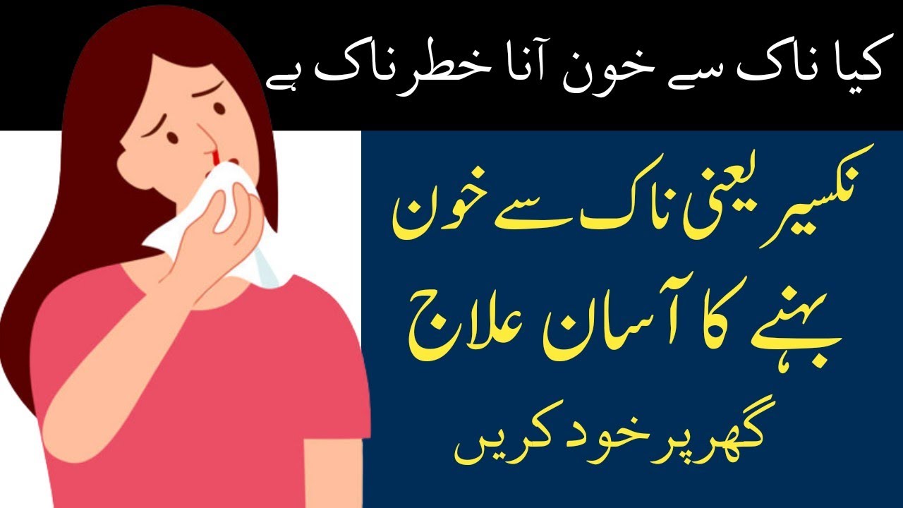 Epistaxis Nose Bleeding Causes & Treatment | Naak Se Khoon Aane Ke Wajah aur | ilaj Nakser ka ilaj