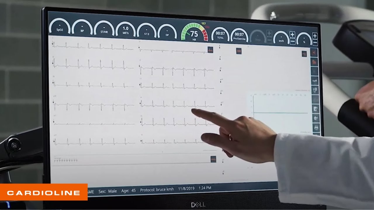 Nuovo Cubestress System (ITA)