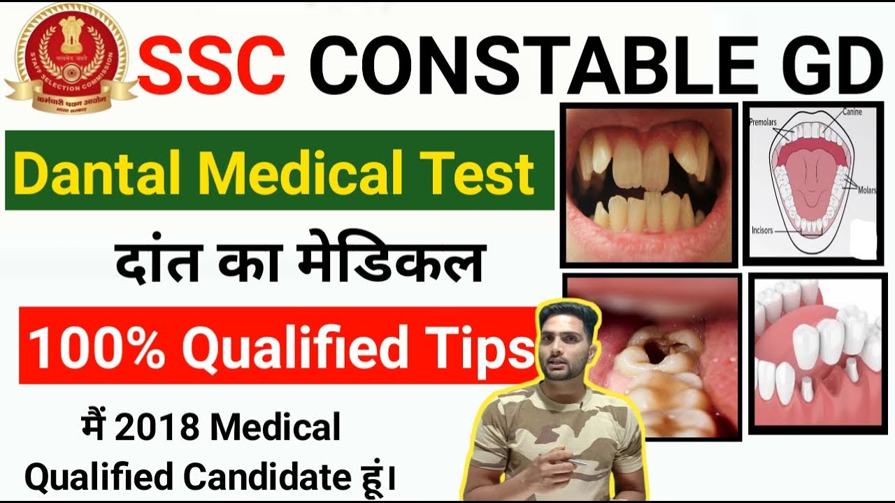SSC GD Danton ka Medical Dental Test Constable Teeth Point