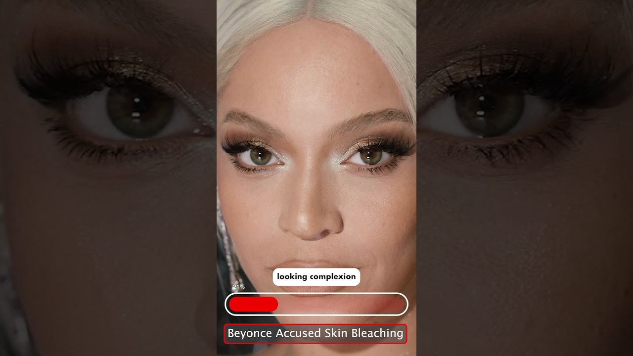 Beyonce Skin Bleaching Saga