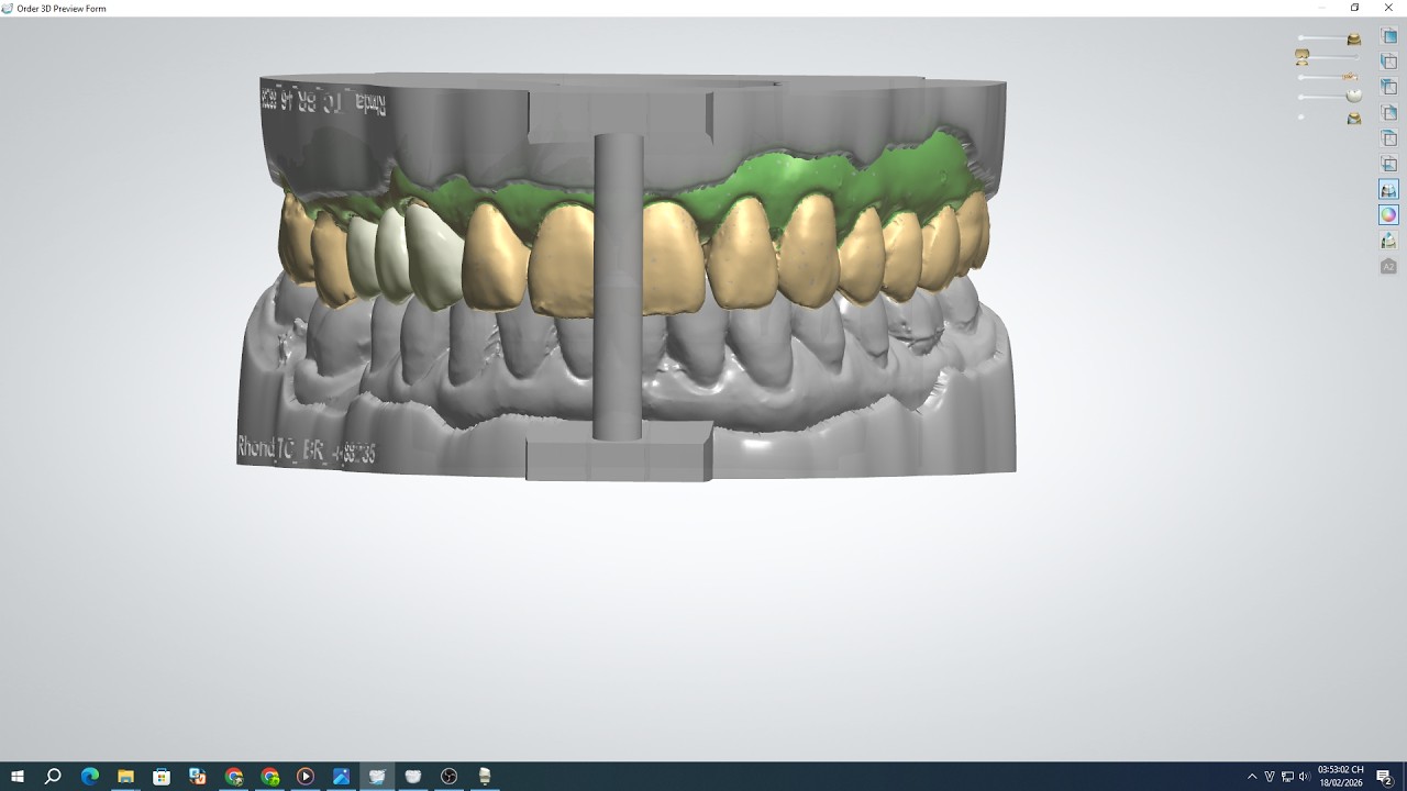 Designing Ceramic Crowns Using 3Shape Software _Thiết Kế Răng Sứ Trên 3Shape