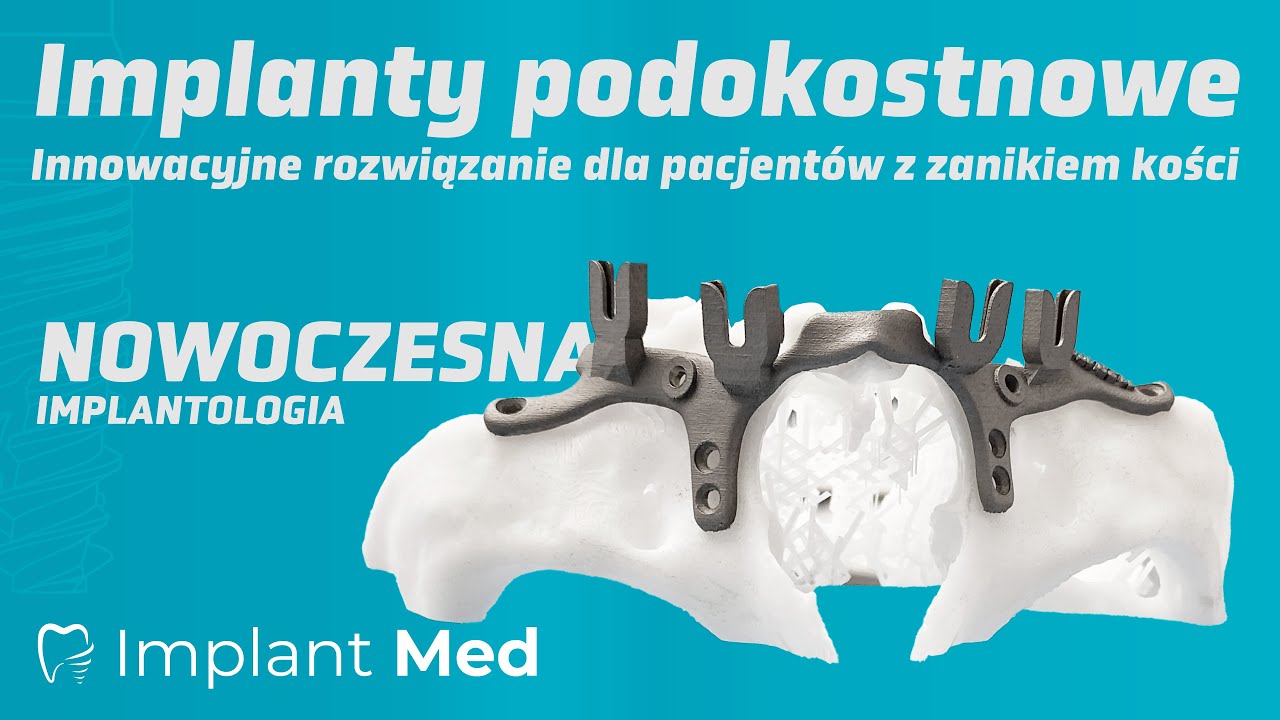 Implanty podokostnowe – innowacyjne rozwiązanie dla pacjentów z zanikiem kości.