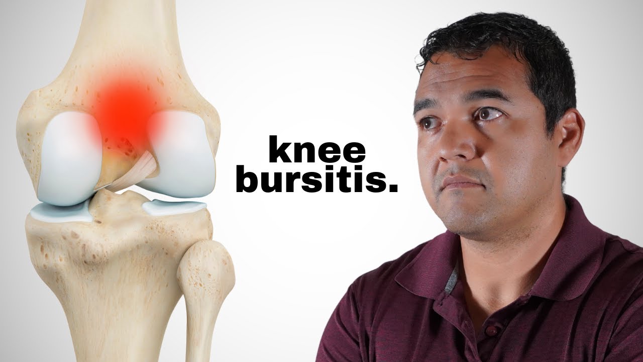 Knee Bursitis: Causes, Symptoms, and Treatment Options