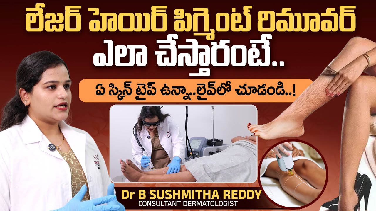 Hair Pigmentation Remover LIVE Treatment | Dr B Sushmitha Reddy | Serum Luxe Clinics | PlayEven
