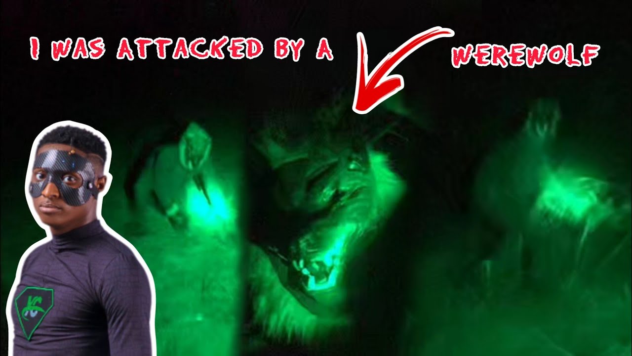 I Was Attacked By A WereWolf In A Forest At Night
