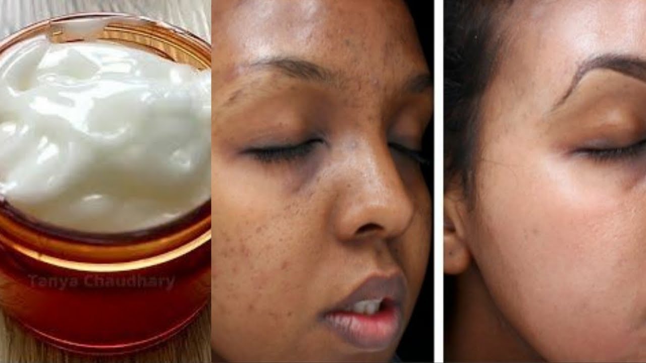 How to make potato face cream to clear face, dark spots, wrinkles and pigmentation |potato starch