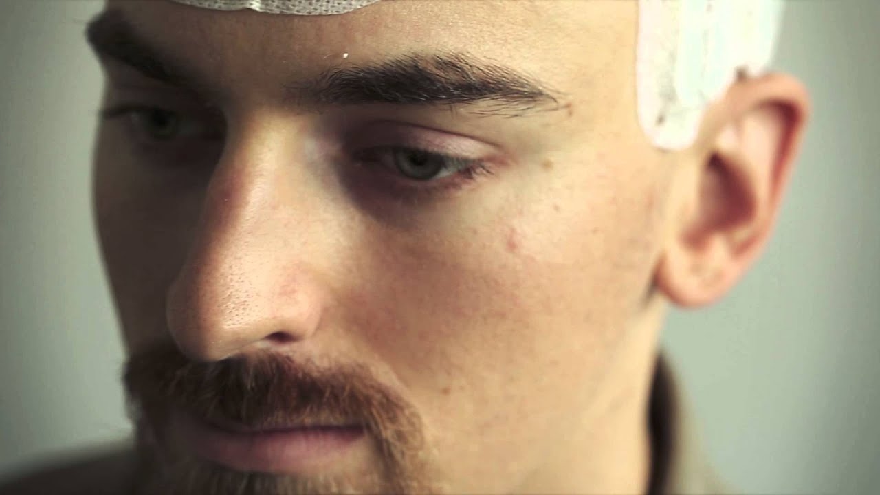 Glioblastoma Multiforme - Denis' Story