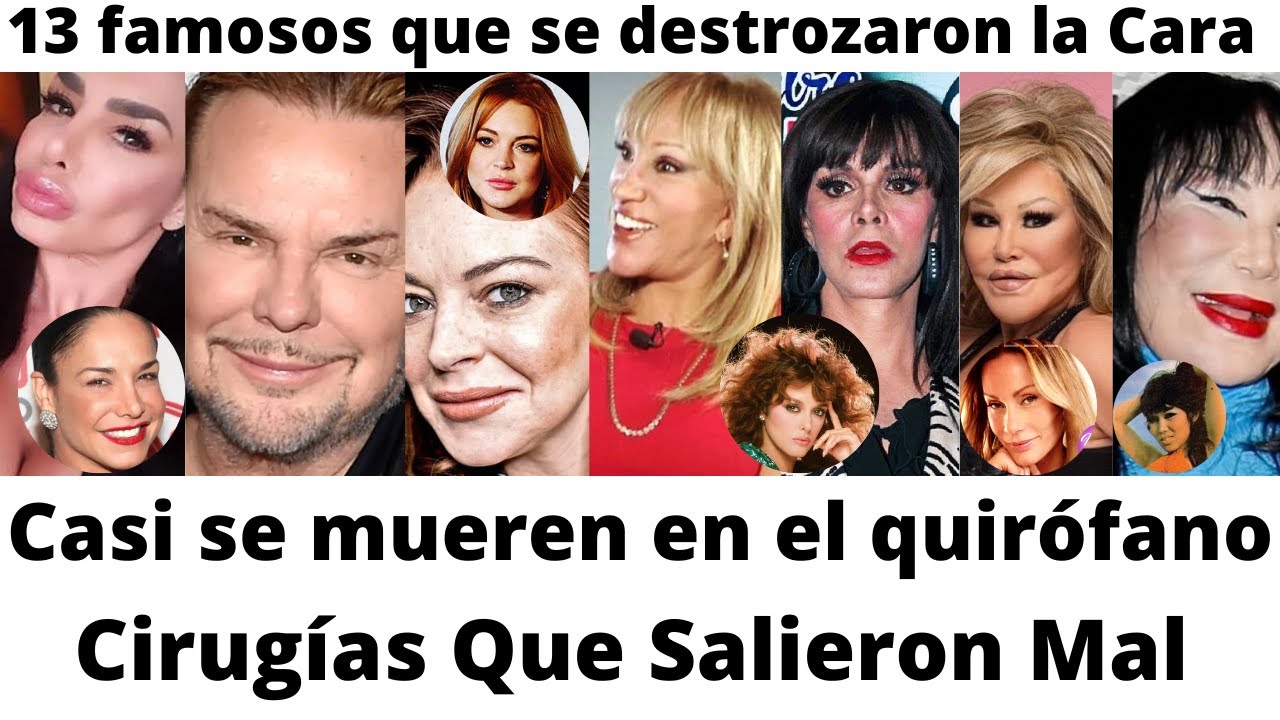 Las cirugías plásticas de los famosos que salieron mal