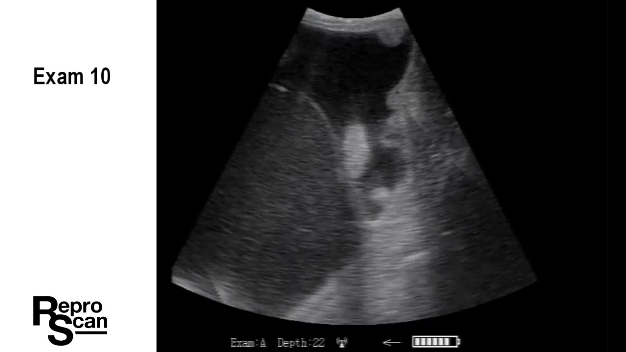 Second Trimester Heifers 17 Exams