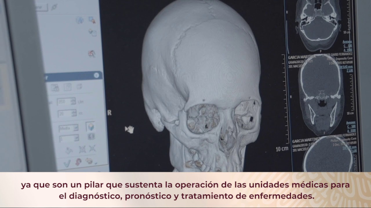 Aplica ISSSTE estrategias para el uso racional y óptimo de procedimientos de radiología