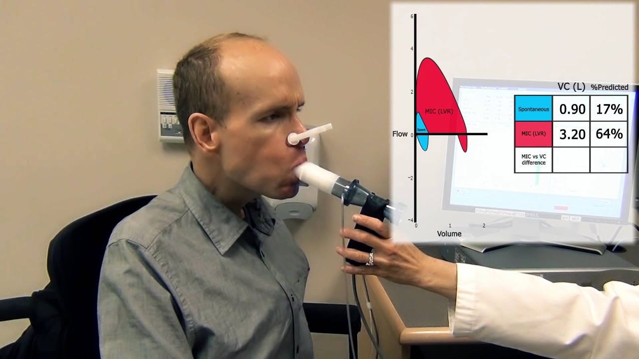 Lung Volume Recruitment with Manual Resuscitation Bag