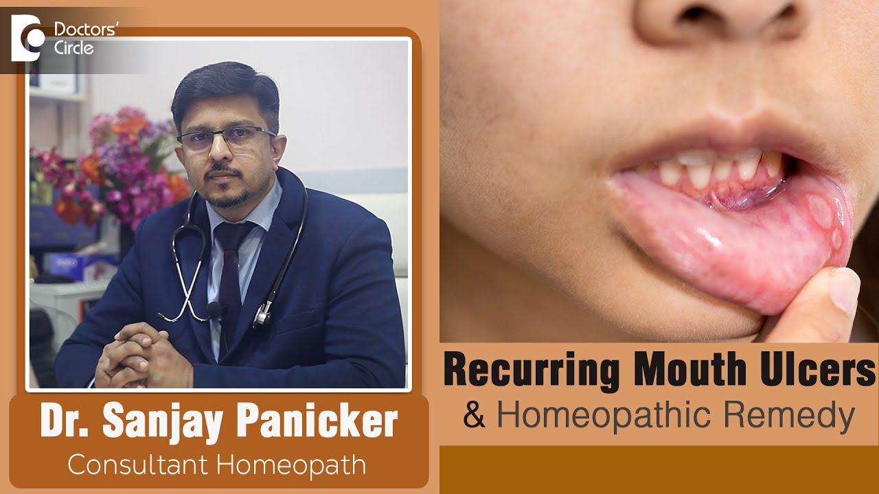 10 Main Causes of Recurring Mouth Ulcers & Homeopathic Treatment-Dr.Sanjay Panicker| Doctors' Circle