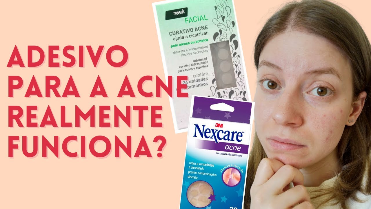 O Melhor Tipo de Adesivo para Secar Espinhas! | Adesivo Hidrocoloide - diferentes tipos, como usar