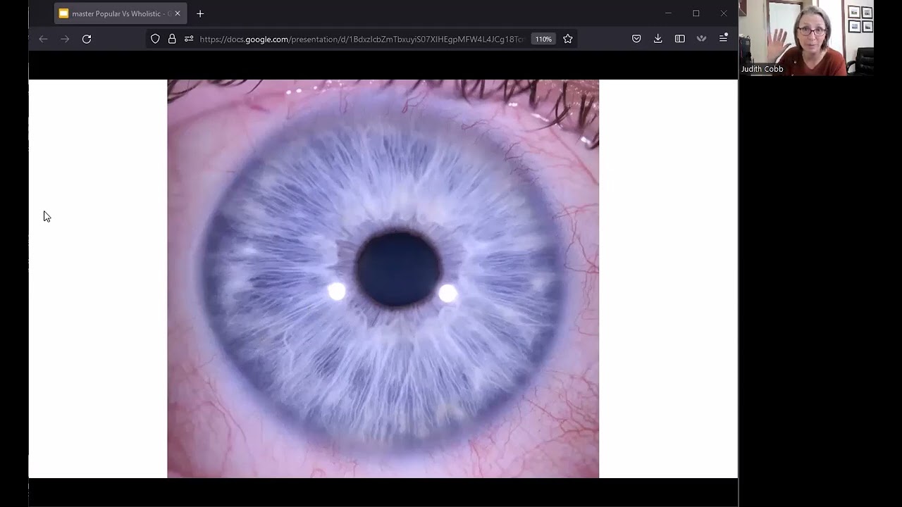 Comparing Jensen-style iridology to Constitutional iridology