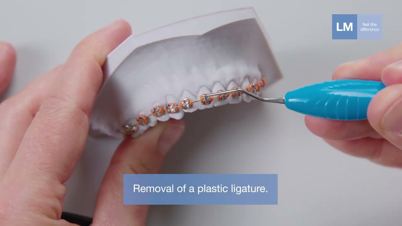 How to use LM™ Ligature On-Off SL instrument