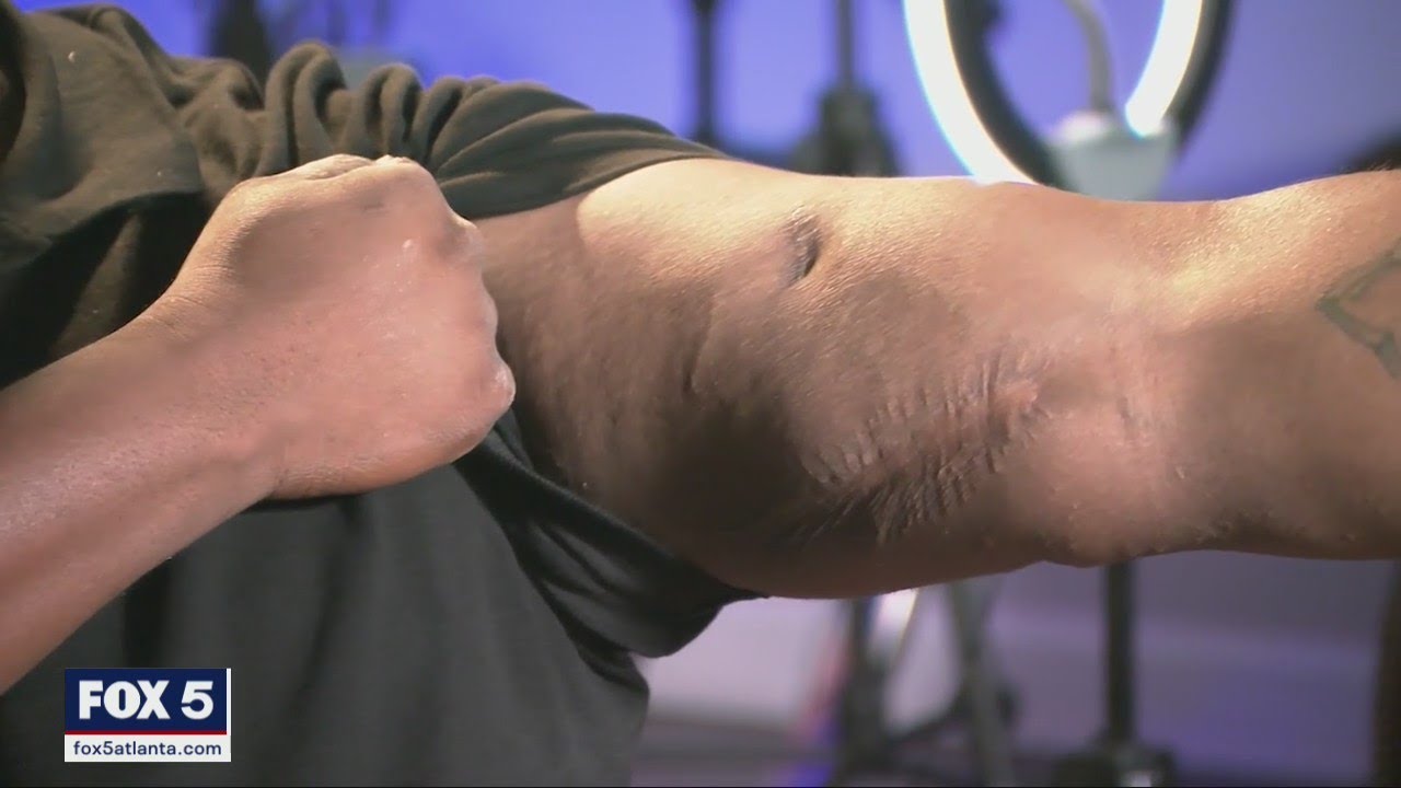 Stories of Survival: Man opens up about shooting that left him paralyzed