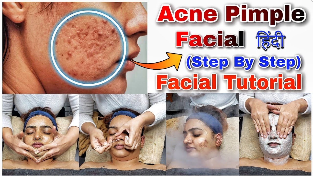 Acne Pimple Facial | Facial Tutorial Hindi | Facial steps | Facial कैसे करते हैं  | Sumansi Sahgal