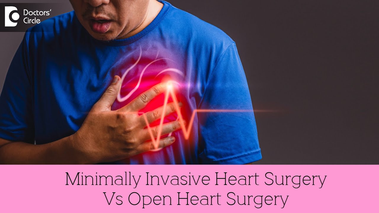 Minimally Invasive Heart Surgery Vs Open Heart Surgery - Dr. Durgaprasad Reddy B | Doctors' Circle