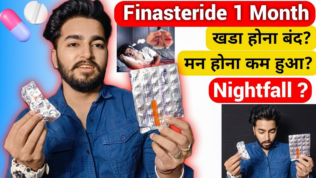 Finasteride 1 Month Experience | Sahil Nagpal