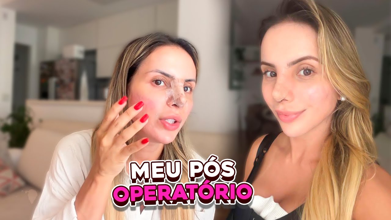 TUDO SOBRE O PÓS OPERATÓRIO DAS MINHAS CIRURGIAS | COMO ME RECUPEREI RÁPIDO? | ISA PEREIRA 