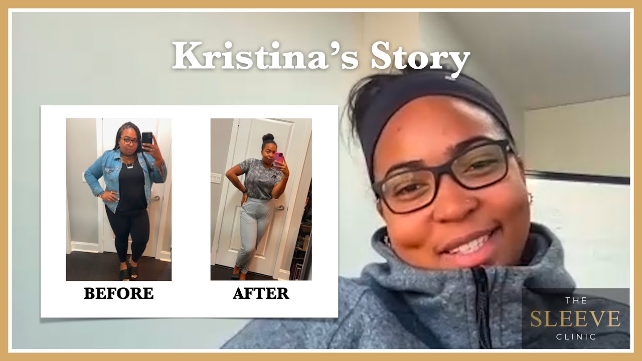 Kristina’s Journey To Losing 119 lbs With The Sleeve Clinic