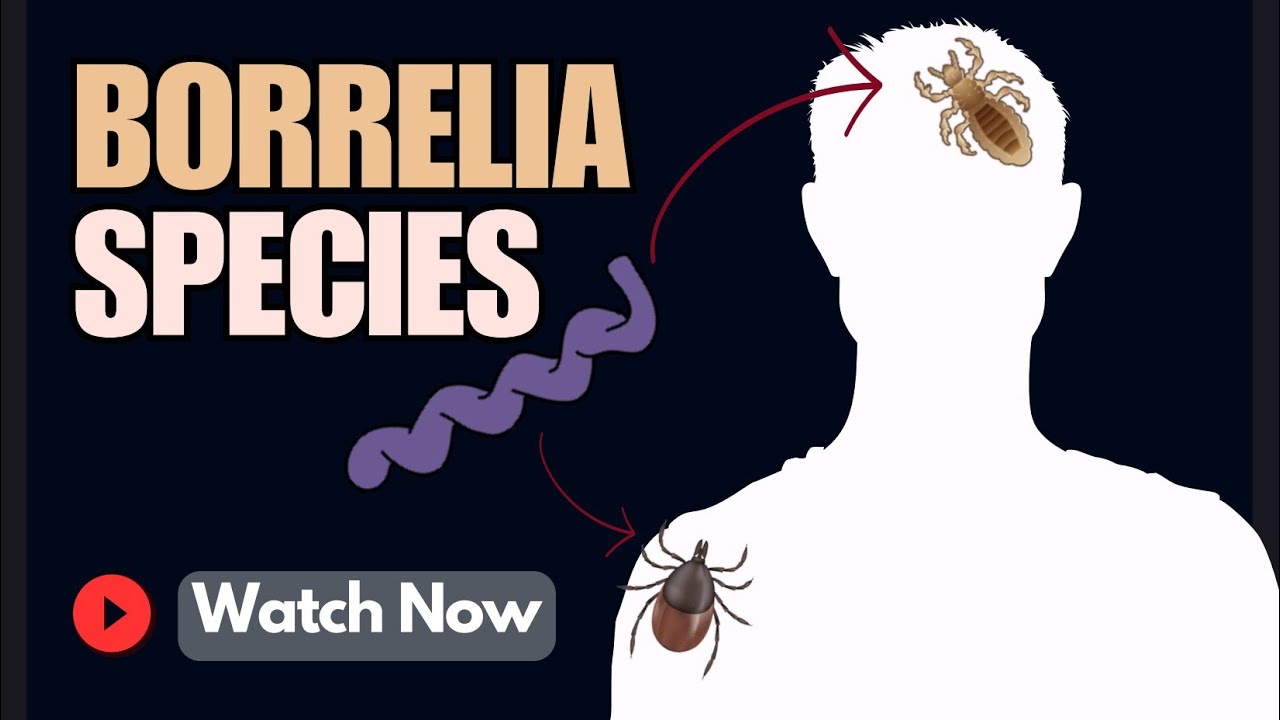 Relapsing Fever: Symptoms, Causes, Diagnosis & Treatment (Borrelia Species) | Microbiology 101