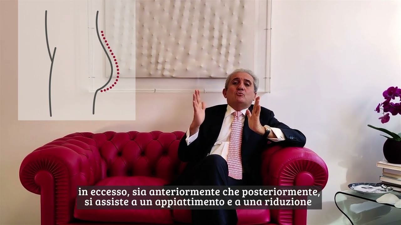 L'intervento di lifting circonferenziale