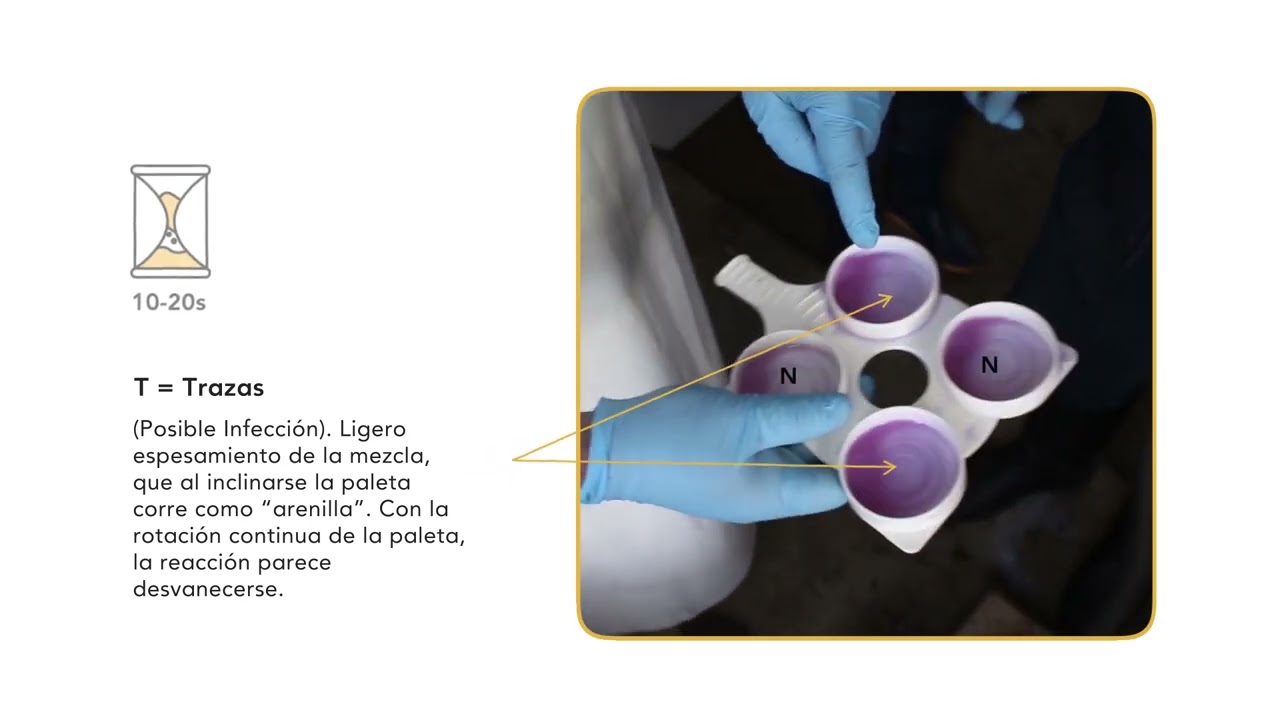 TMSPL - Producción Animal aplicada al SPL 1 - California Mastitis Test