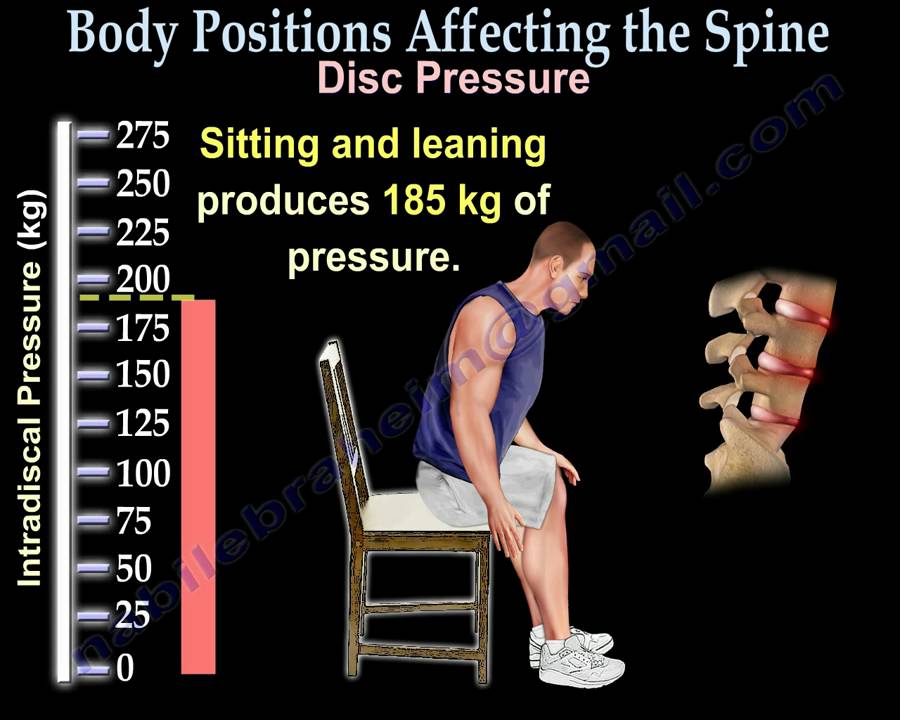 Body Positions Affecting the spine and discs - Everything You Need To Know - Nabil Ebraheim, M.D.