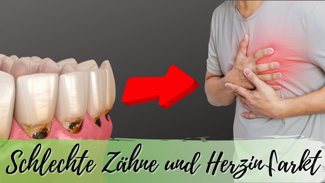 🦷 Gesunde Zähne als Basis für einen gesunden Körper 🦷 (Parodontitis & CMD) Dr. Nicole Lenz