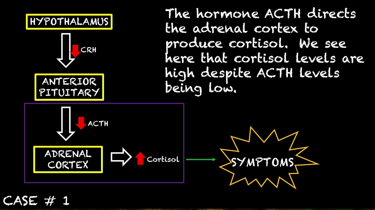 Human Physiology # 57 - Endocrine Pathologies