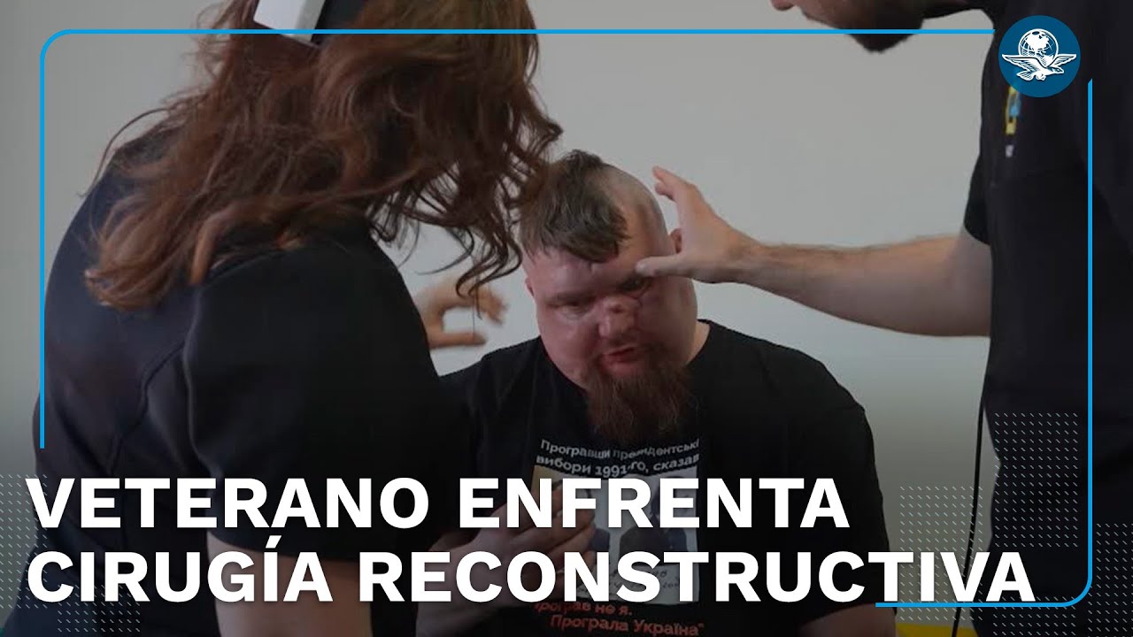Cirugías reconstructivas devuelven la vida a veteranos de Ucrania tras quedar desfigurado