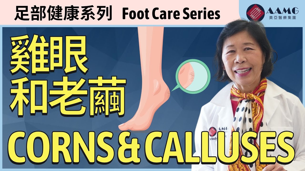 (中文字幕) 足科醫生為你介紹灰指甲的治療方法 Foot Doctor Explains Corns & Calluses | 美亞醫療集團 AAMG