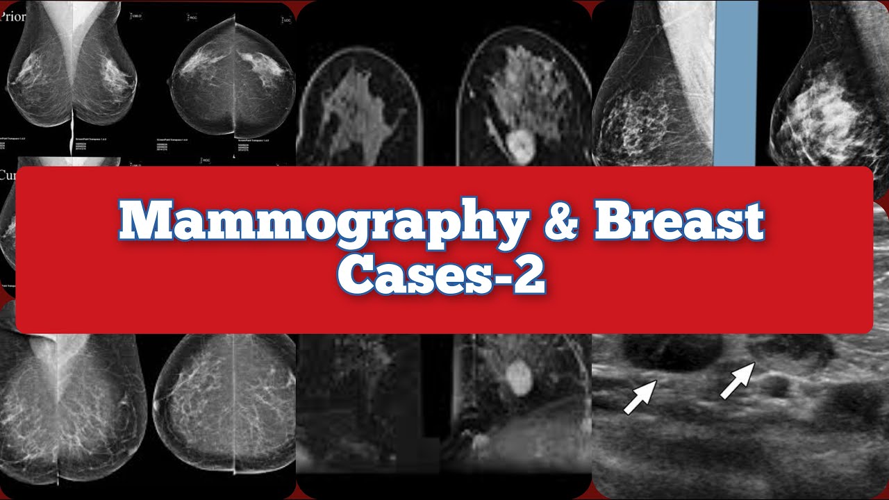 Radiology Viva Cases # 352-356 | Mammography & Breast Cases Part-2 #medical #radiology #ultrasound