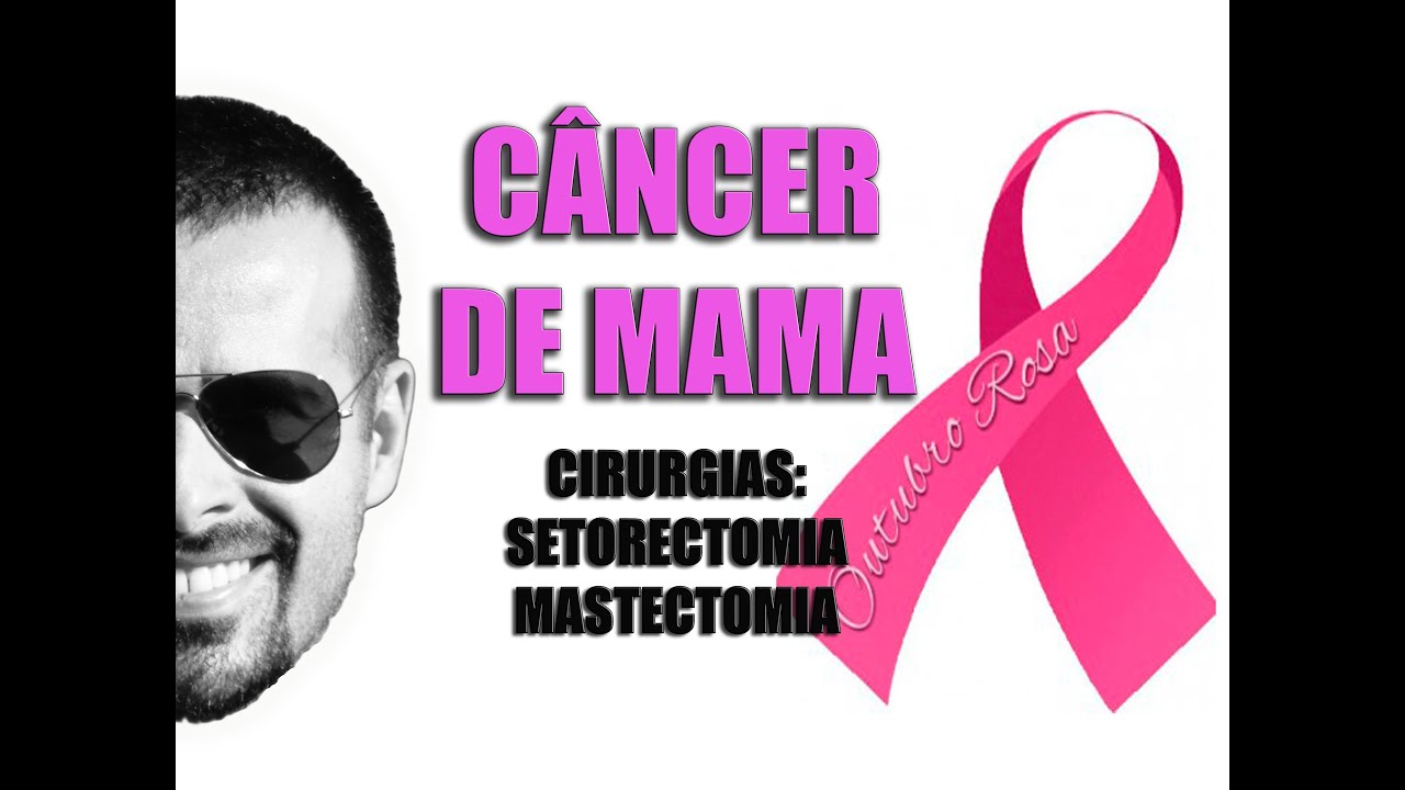 Câncer de Mama: Cirurgias de Mastectomia e Setorectomia - VídeoAula 089
