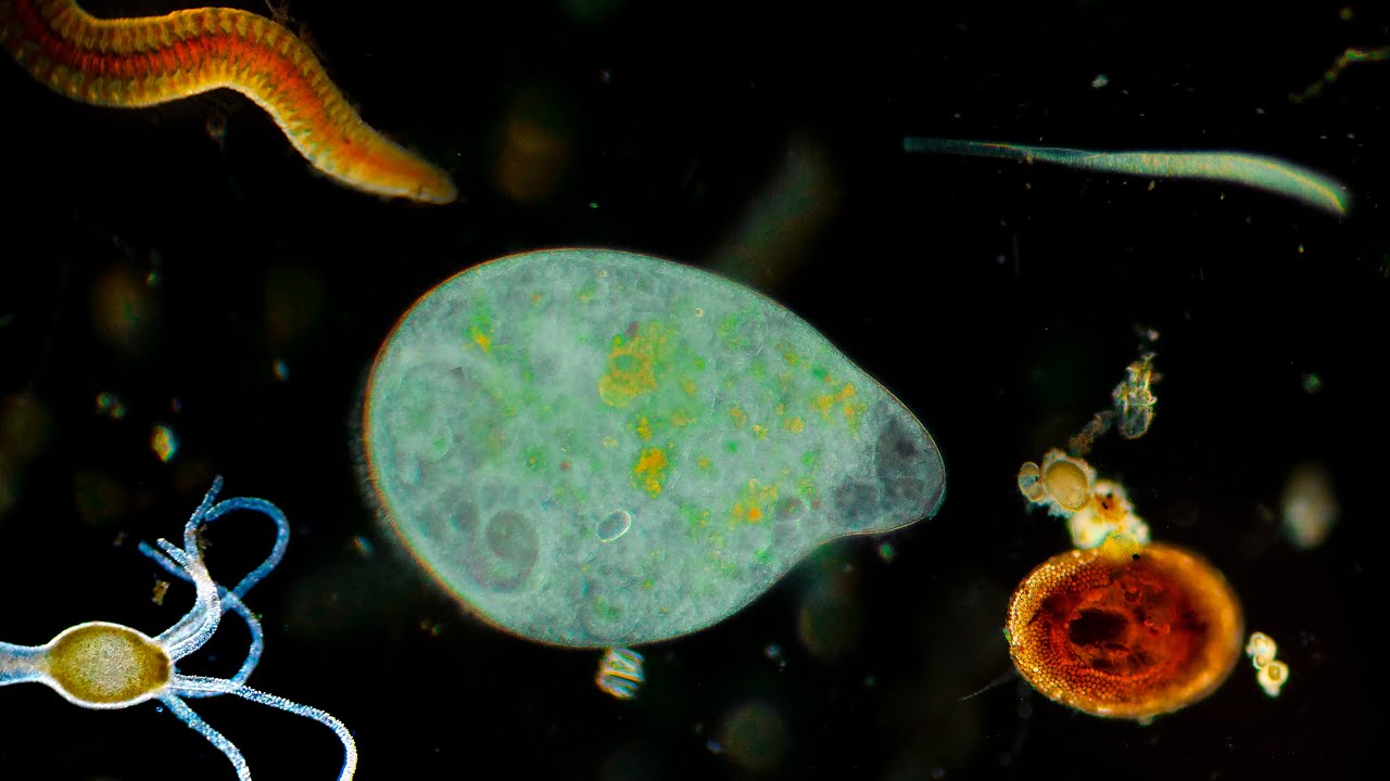 WHAT CAN BE SEEN IN THE WATER DROP FROM THE CITY LAKE UNDER THE MICROSCOPE FOR $1000?