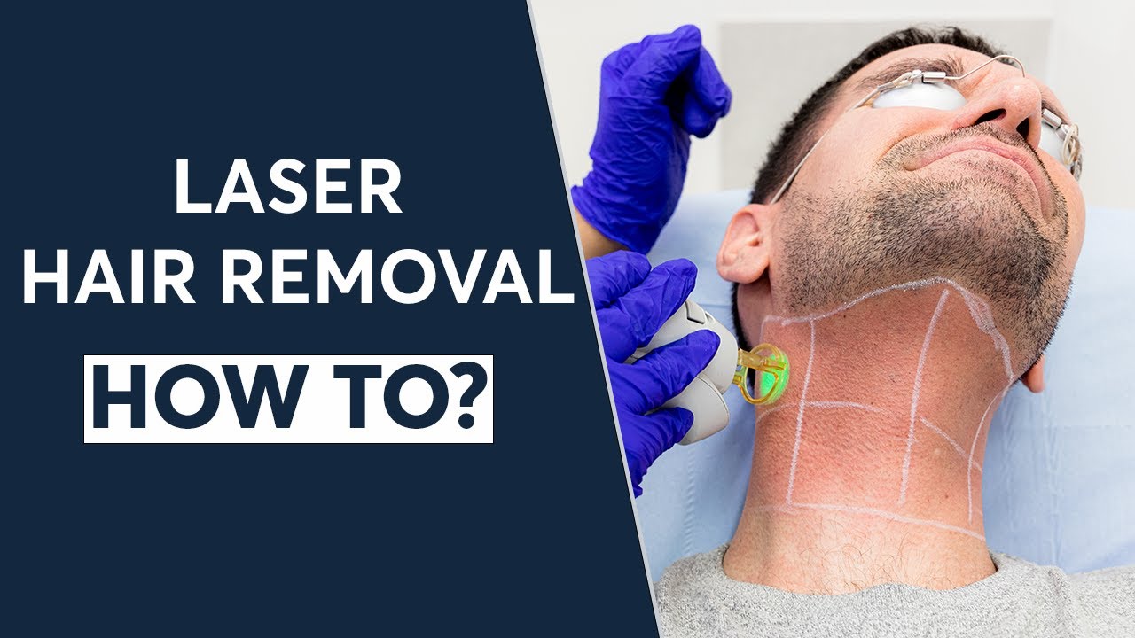 HOW TO: Reduce Body Hair Using Laser Hair Removal | London