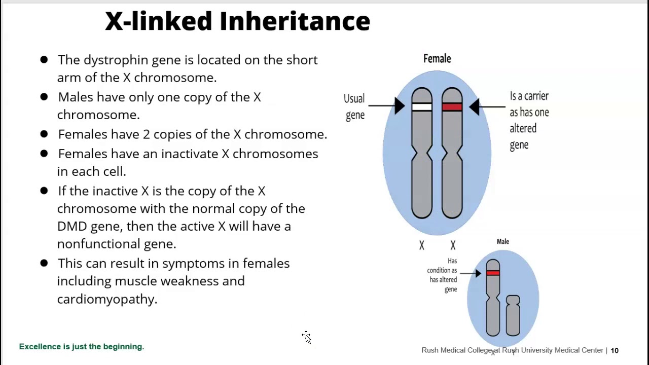 Genetics of Dystrophinopathies, Duchenne, Beckers and Myoton