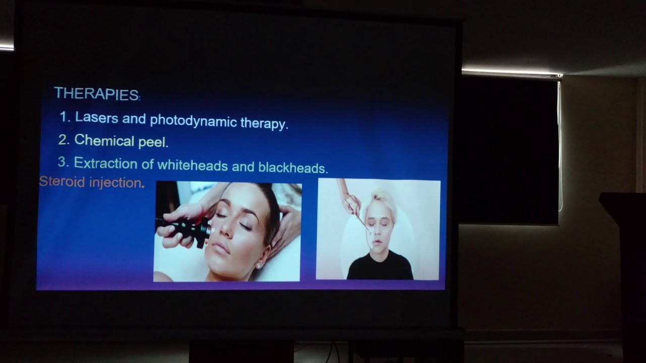 Acne Vulgaris lecture by Dr Hira Naz (part 2)