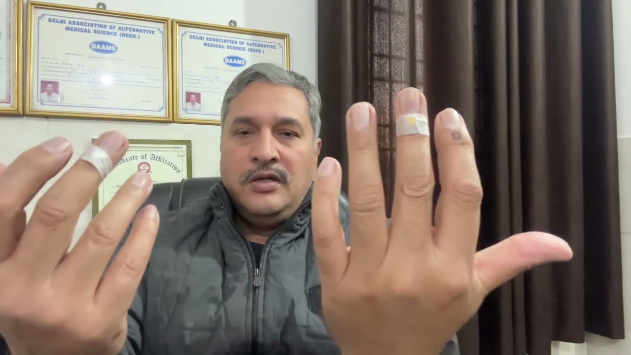 Weather change problem Seasonal Problems Treatment by Acupressure #seasonalallergies