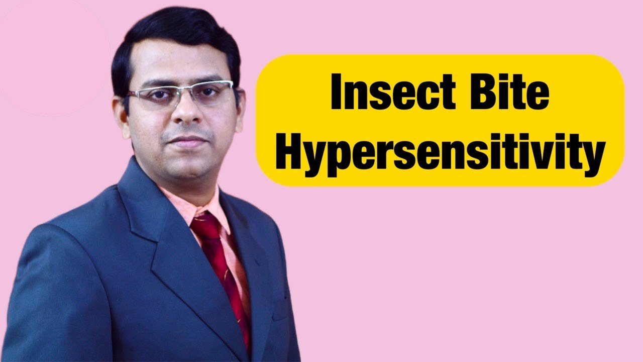 Insect Bite Hypersensitivity | Papular Urticaria