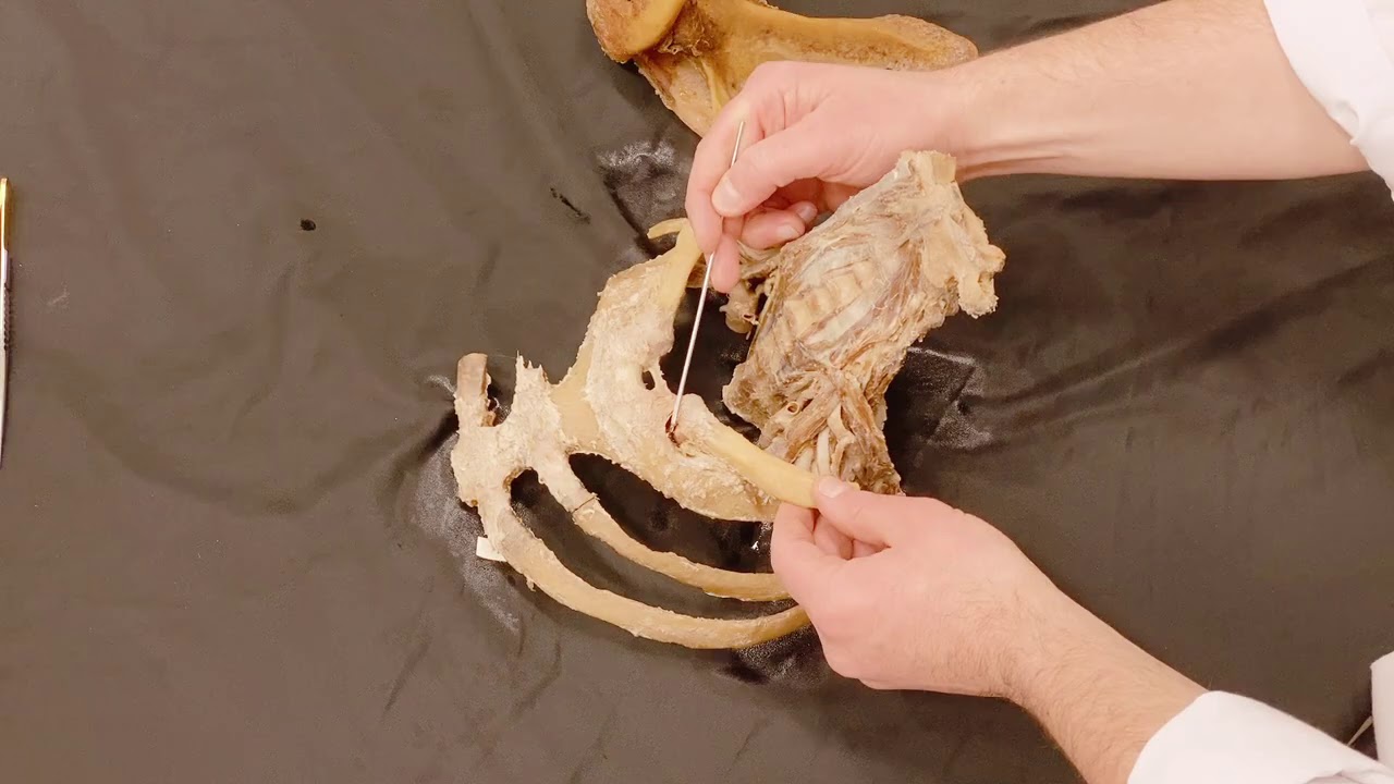 Der Schlüssel zur oberen Extremität: Artt. sterno- et acromioclavicularis kurz und knackig!