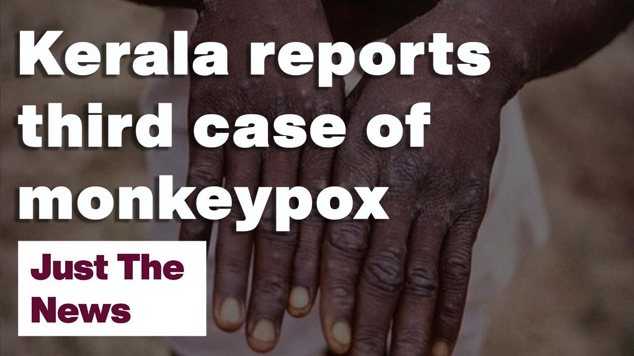 Kerala reports third case of monkeypox: Just The News: 22-07-2022