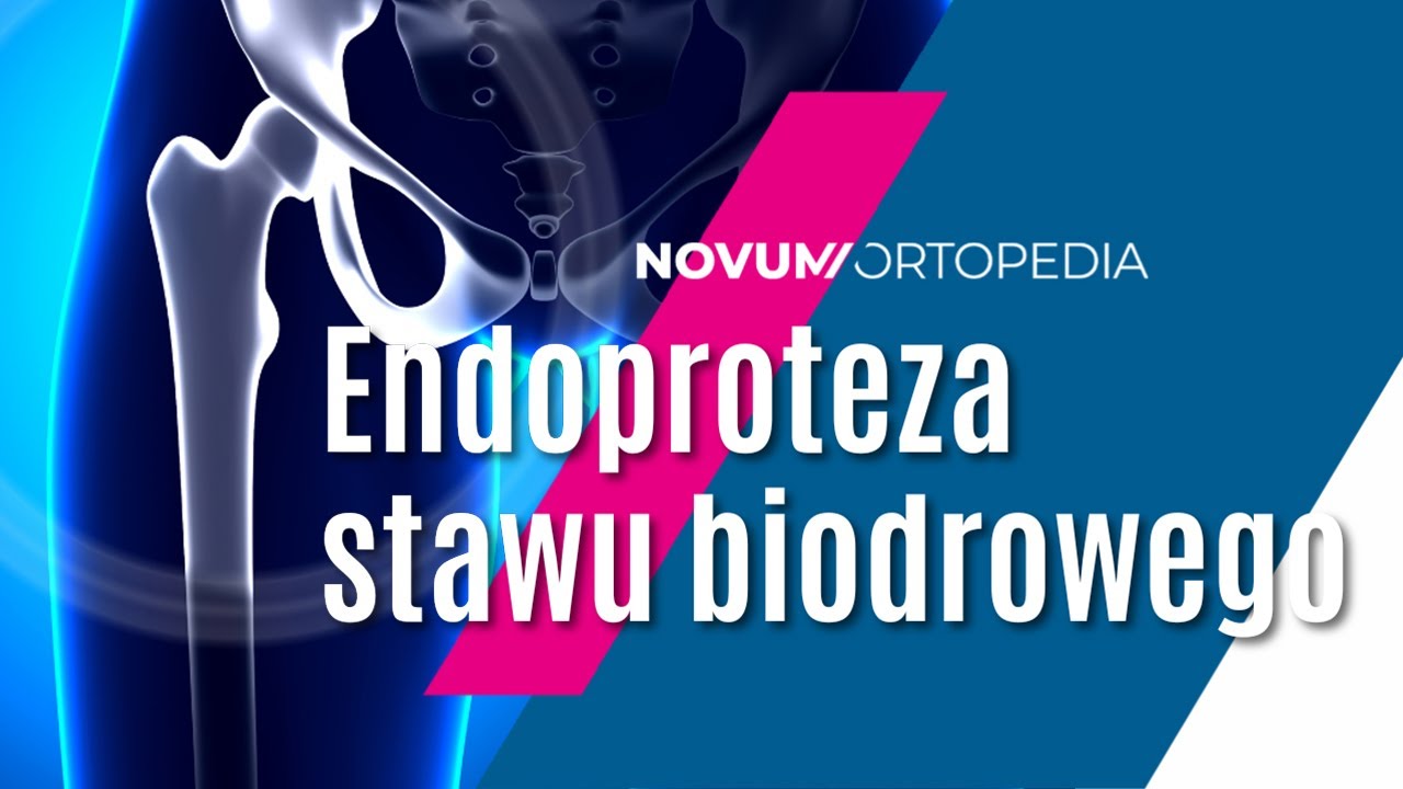 Budowa i funkcjonalność endoprotezy stawu biodrowego | Novum Ortopedia