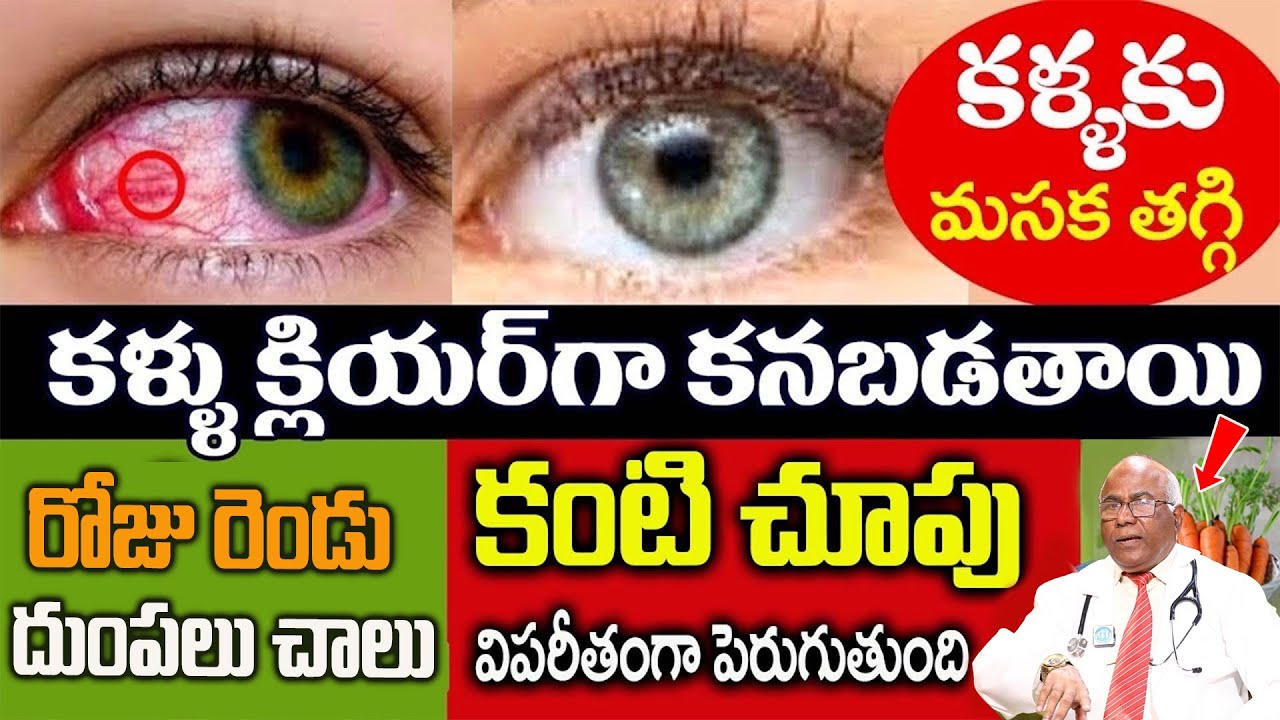 ఒక్కదుంపతోకంటికి ఉన్నఅద్దాలు విసిరి కొడతారు | Your eyesight will increase 10 times|Dr.CL Venkata rao