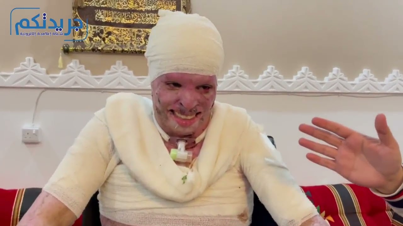 بالبداية دموع وحزن.. واليوم دموع الفرح بإستلام الشاب #البدون طلال جواز سفره للعلاج بالخارج