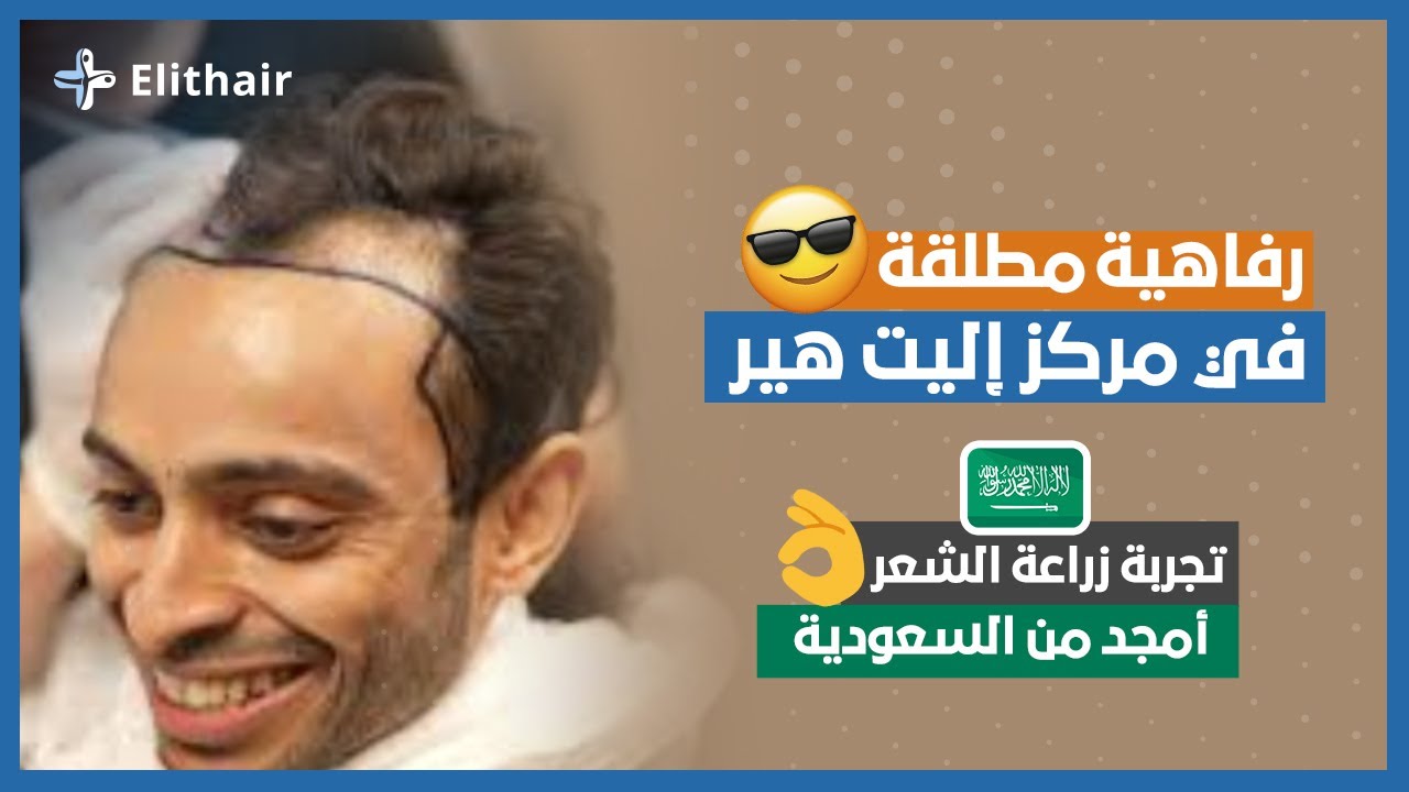 زراعة الشعر في تركيا | تجربة السيد أمجد من المملكة العربية السعودية | إليت هير